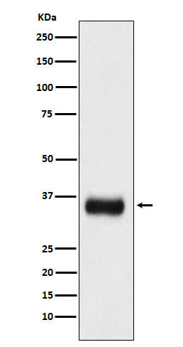 Anti-SF2 Monoclonal Antibody Boster Bio