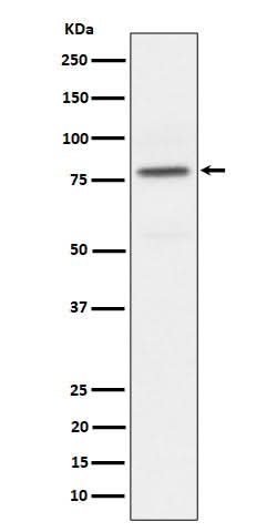 Anti-Phospho-PKC alpha (T497) Rabbit Monoclonal Antibody Boster Bio