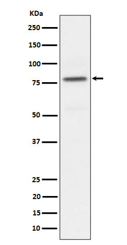 Anti-Phospho-PKC alpha (T497) Rabbit Monoclonal Antibody Boster Bio