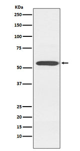 Anti-Cytochrome P450 2D6 CYP2D6 Monoclonal Antibody Boster Bio
