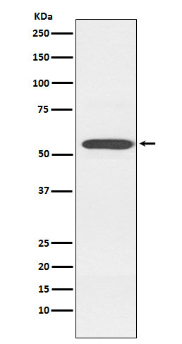 Anti-Cytochrome P450 2D6 CYP2D6 Monoclonal Antibody Boster Bio