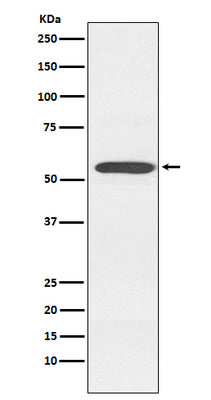 Anti-Cytochrome P450 2D6 CYP2D6 Monoclonal Antibody Boster Bio