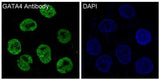 Anti-GATA4 Rabbit Monoclonal Antibody Boster Bio