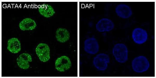 Anti-GATA4 Rabbit Monoclonal Antibody Boster Bio
