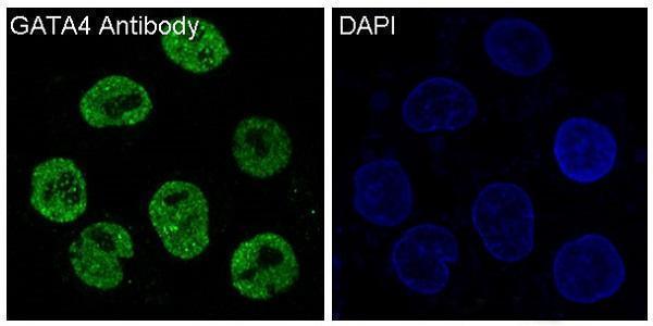 Anti-GATA4 Rabbit Monoclonal Antibody Boster Bio