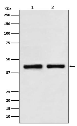 Anti-SNF5 SMARCB1 Rabbit Monoclonal Antibody Boster Bio