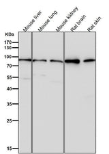 Anti-GR NR3C1 Rabbit Monoclonal Antibody Boster Bio