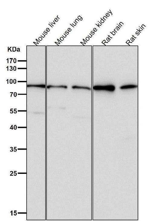 Anti-GR NR3C1 Rabbit Monoclonal Antibody Boster Bio