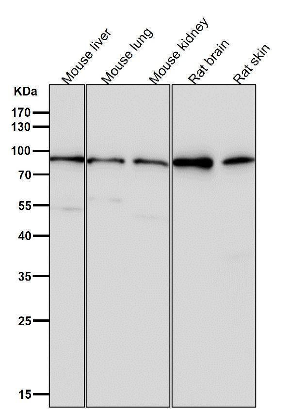 Anti-GR NR3C1 Rabbit Monoclonal Antibody Boster Bio