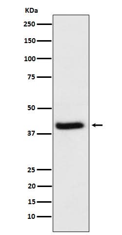 Anti-HFE Rabbit Monoclonal Antibody Boster Bio