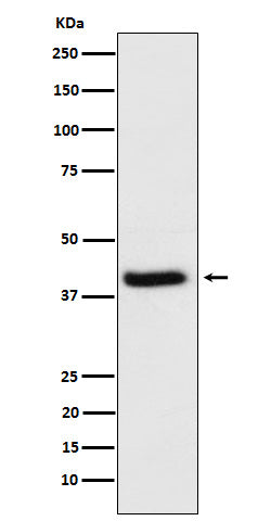 Anti-HFE Rabbit Monoclonal Antibody Boster Bio