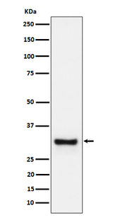 Anti-Adiponectin Rabbit Monoclonal Antibody Boster Bio