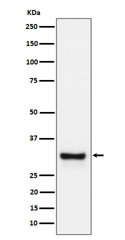 Anti-Adiponectin Rabbit Monoclonal Antibody Boster Bio