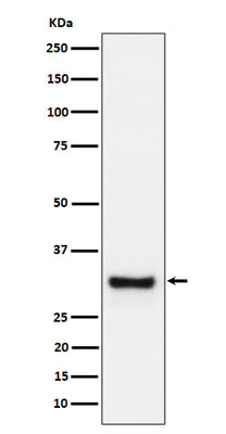 Anti-Adiponectin Rabbit Monoclonal Antibody Boster Bio