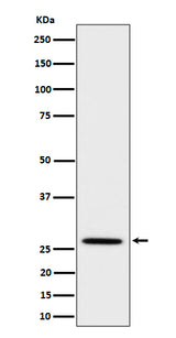 Anti-Adiponectin Rabbit Monoclonal Antibody Boster Bio
