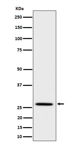 Anti-Adiponectin Rabbit Monoclonal Antibody Boster Bio