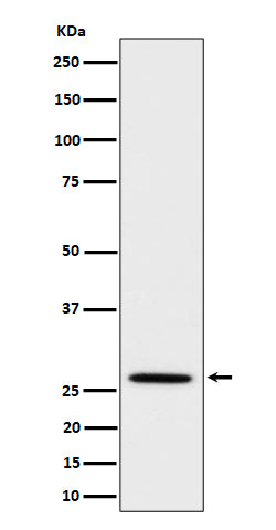 Anti-Adiponectin Rabbit Monoclonal Antibody Boster Bio