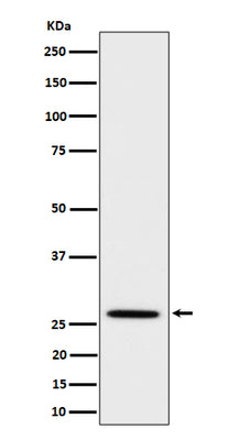 Anti-Adiponectin Rabbit Monoclonal Antibody Boster Bio