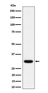 Anti-Adiponectin Rabbit Monoclonal Antibody Boster Bio