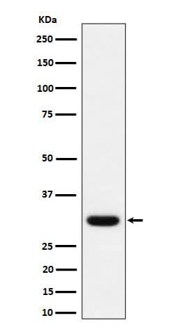 Anti-Adiponectin Rabbit Monoclonal Antibody Boster Bio