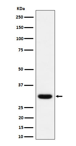 Anti-Adiponectin Rabbit Monoclonal Antibody Boster Bio