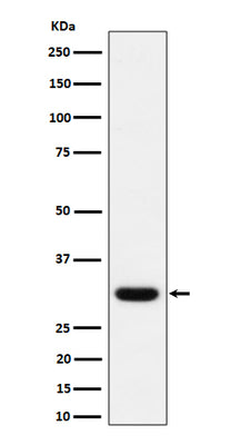 Anti-Adiponectin Rabbit Monoclonal Antibody Boster Bio
