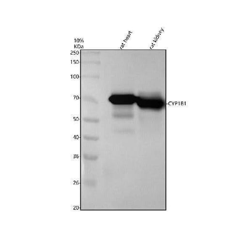 Anti-CYP1B1 Rabbit Monoclonal Antibody Boster Bio