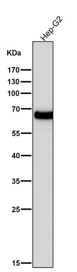 Anti-AFP/Alpha 1 Fetoprotein Rabbit Monoclonal Antibody Boster Bio