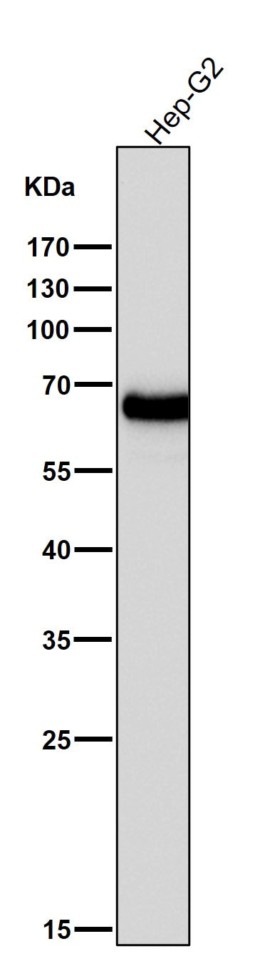 Anti-AFP/Alpha 1 Fetoprotein Rabbit Monoclonal Antibody Boster Bio