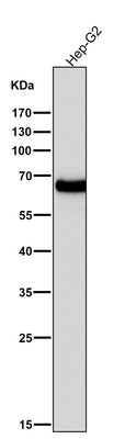 Anti-AFP/Alpha 1 Fetoprotein Rabbit Monoclonal Antibody Boster Bio