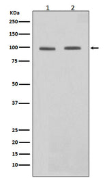 Anti-STAT6 Rabbit Monoclonal Antibody Boster Bio