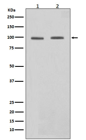 Anti-STAT6 Rabbit Monoclonal Antibody Boster Bio