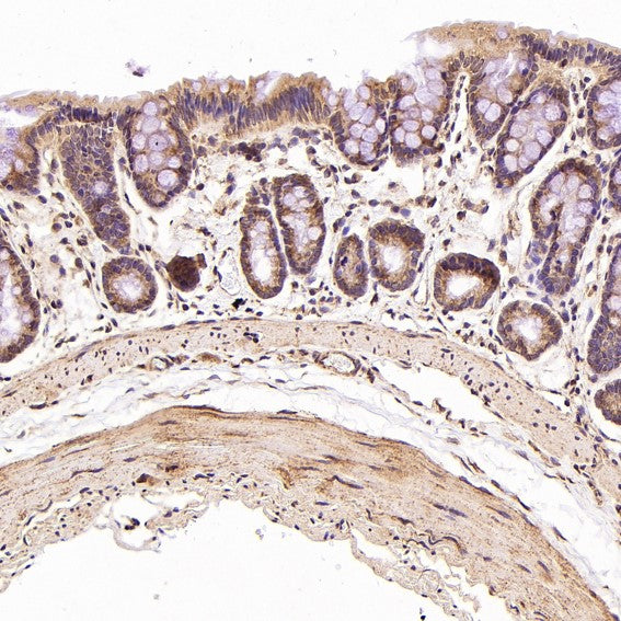 Anti-STAT6 Rabbit Monoclonal Antibody Boster Bio