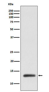 Anti-ROC1 Monoclonal Antibody Boster Bio