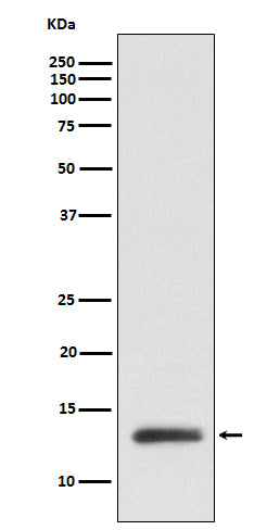 Anti-ROC1 Monoclonal Antibody Boster Bio