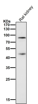 Anti-Gli1 Rabbit Monoclonal Antibody Boster Bio