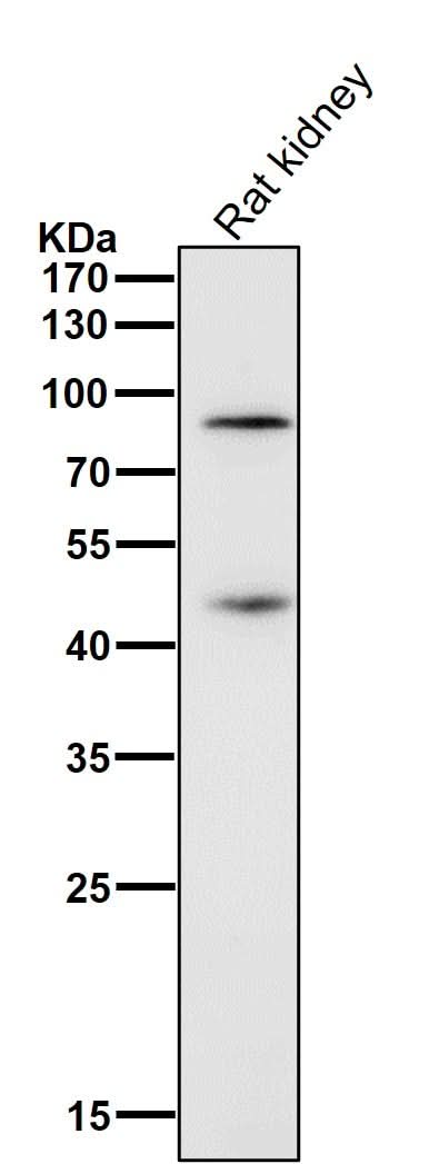 Anti-Gli1 Rabbit Monoclonal Antibody Boster Bio