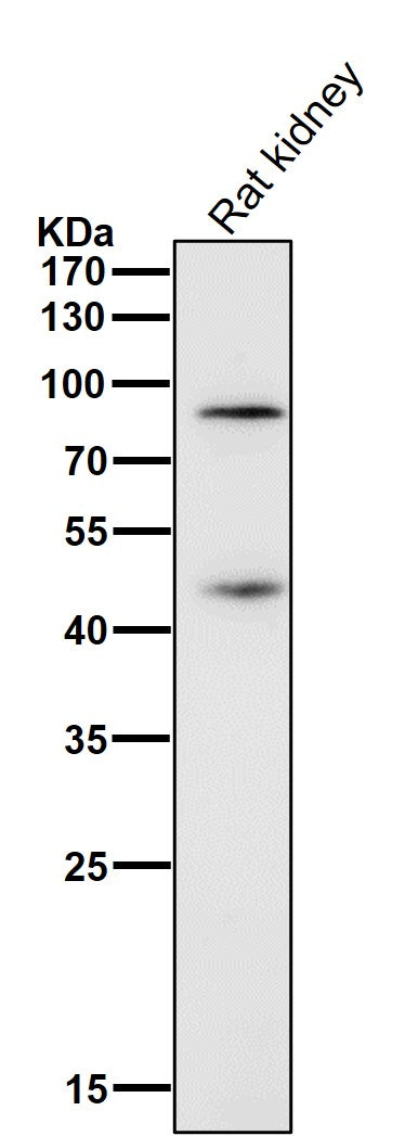 Anti-Gli1 Rabbit Monoclonal Antibody Boster Bio