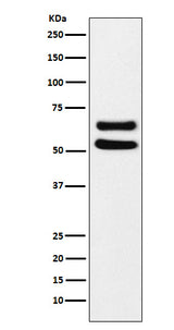 Anti-Ikaros Monoclonal Antibody Boster Bio