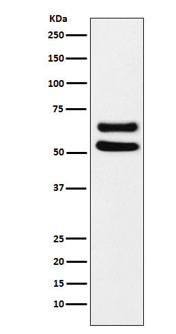 Anti-Ikaros Monoclonal Antibody Boster Bio