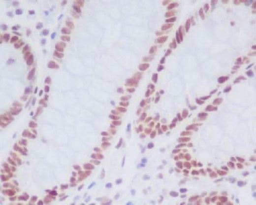 Anti-KDM1/LSD1 KDM1A Rabbit Monoclonal Antibody Boster Bio