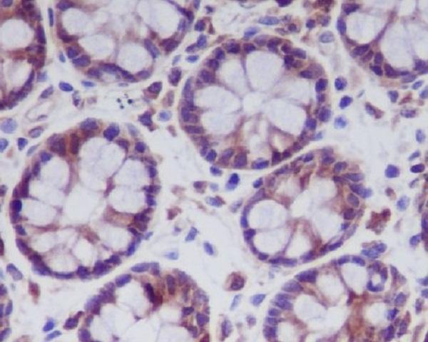 Anti-MLKL Rabbit Monoclonal Antibody Boster Bio