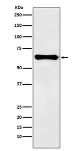 Anti-Factor IX Rabbit Monoclonal Antibody Boster Bio