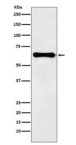 Anti-Factor IX Rabbit Monoclonal Antibody Boster Bio