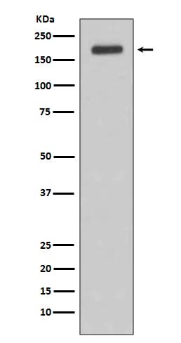 Anti-ErbB (HER3) Rabbit Monoclonal Antibody Boster Bio