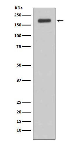 Anti-ErbB (HER3) Rabbit Monoclonal Antibody Boster Bio
