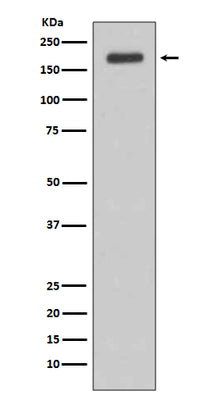 Anti-ErbB (HER3) Rabbit Monoclonal Antibody Boster Bio