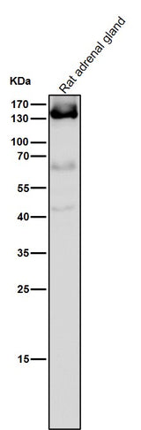 Anti-Androgen Receptor AR Rabbit Monoclonal Antibody Boster Bio