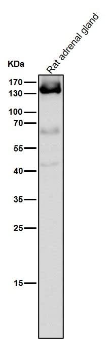Anti-Androgen Receptor AR Rabbit Monoclonal Antibody Boster Bio