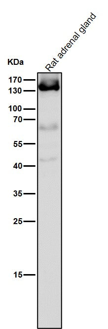 Anti-Androgen Receptor AR Rabbit Monoclonal Antibody Boster Bio